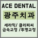 에이스 덴탈 이미지