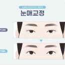 광주성형외과의원 이미지