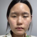 [이대역경락] 이대역 경락 새라본 신촌이대본점 얼굴경락 후기
