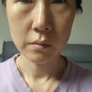 이혈요법 | 연예인귀침 찾다가 발견한 wbL 스왈 크리스탈 이혈패치 솔직후기