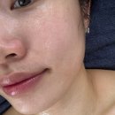 파코메리화장품 | 마곡역 피부맛집 뷰티스테이 강서점 후기