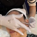 미헤어라인 | 동탄 영천동 바이미왁싱에서 헤어라인 및 왁싱 플래닝 받은 후기