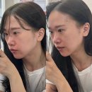 다사세천피부관리 비앤제이뷰티에서 입소문난 윤곽관리 확실하게 받은 후기