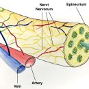 초음파, 약침으로 신경 유착 떼기 hydrodissection 이미지