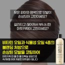 주톡스 이미지