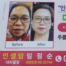 소망 인셀덤 이미지