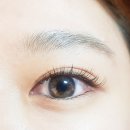 더예쁜eye 이미지