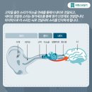 독일시그니아보청기 서면센터 이미지