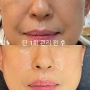 파주·운정 하루 코스와 운정피부관리 서연뷰티 방문 후기