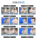 히너