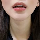 수정기공사 | 무삭제라미네이트 블랙필름 선택한 솔직 후기