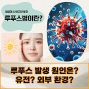 국민건강보험공단 부산사하지사 | 부산 사하 루푸스 산정특례 제도에 대한 정보와 등록 기준 안내