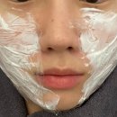 피부관리사 (주간) | 서울 안 아픈 리쥬란 2cc 내돈내산 후기 (스레드 피부과, 여드름 피부 리쥬란 후기)