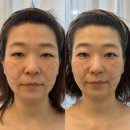 가꾸는동안(뷰티나) | 가꾸는동안 &amp; 숲칼프 재방문 후기 ㅣ 잊지 못해 다시 찾은 진짜 관리의 힘 내돈내산 의정부피부관리...