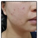 생생어성초 영농조합 법인 | 천연 세안비누추천 생생어성초 천연비누 후기