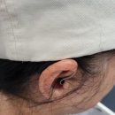 서울탑보청기 이미지