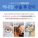 아이준안과 네이버블로그