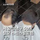 서울 강남구 강남 탈모커버 스핀스왈로펌도 보완 가능