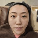 건대입구역 | 건대입구역피부과 콰드로 피코토닝 후기 이정도라니 레이저토닝