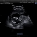 태전포도나무산부인과의원 이미지