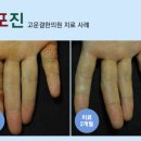 한방피부과학연구소 네이버블로그