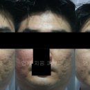 연세지움 Daum카페