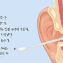 외이도염 원인 초기 통증 이미지