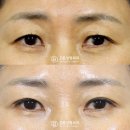디비성형외과의원 이미지