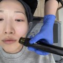 제이메디칼 | 광주 양산동 제이샵뷰티 “알테온 리프팅” 팔자랑 윤곽, 피부결까지 올인원 케어받은 후기