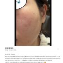 더힐한의원 | [W6.결혼일기]구월동 피부관리, 실리프팅 전문 포메디한의원 토닝&amp;색소제거 솔직후기