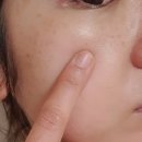 엔도플러스 이미지