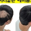 시선을즐기다탈모두피커버헤어라인전문부산점 이미지