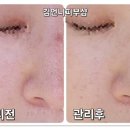 김언니피부샵