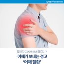 어깨통증 원인과 유연성 강화 기혈체조 [月仙 김용필 칼럼] 이미지