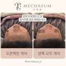 미채움뷰티샵 | [석촌역 헤드스파] 지친 일상 속 특별한 힐링, '미채움 두피 스킨바디'에서 퍼스널 케어 받고 왔어요! ✨