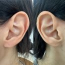 【재능기부강의】 ★힐링 귀터치(이혈)테라피★ | 테라피]귀상담학 | 귀상담 지도사 2급 자격증 취득...관리를 위한 이혈테라피 | 귀상담학 공부를...