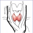 갑상선암 수술 후 목소리 변화에 대해 이미지