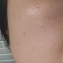 퍼스트메드 이미지