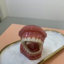 스파클치과교정과치과의원 네이버블로그
