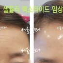 글로벌톡스