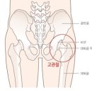 프롤로치료의 장점과 치료방법 이미지