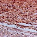 금붕어의 쉬반종(신경초종, schwannoma) 이미지