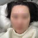 청주 속눈썹펌 잘하는 곳 강추ㅣ무드영ㅣ헤어라인 SMP 까지 같이 받은 찐후기