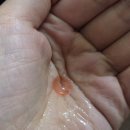 파라곤약국 | 성인 드림렌즈 후기 - [7] 루시드 LK에서 파라곤 CRT렌즈로 교체 후 1~7일