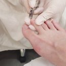 두손네일 - 사상구 사상로238번길 8 | 서울숲네일 두손네일 문제성발톱 후기