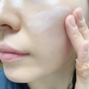 초스피드환경 | 붉은 여드름 흉터 초스피드 진정TIP