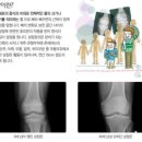 인애가의원 네이버블로그