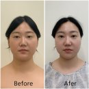 선에너지 | [경기 평택] 평택 피부관리 “선새김에스테틱”에서 에너지테라피 받은 후기