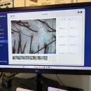 김정문알로에 서구지점 | 웰킨 N년차 회원의 웰킨 두피탈모센터 인천청라점 후기 (겨울철 건조한 두피관리)