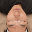 프리뷰티셀플라 이미지